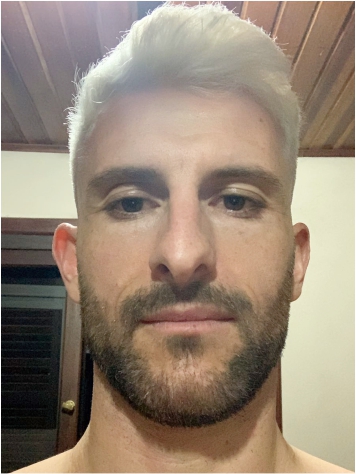 Ewerton-Anotion-Amaral.jpg